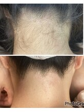 マイレ 銀座(MAILE)/うなじ