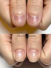 マリーロール 梅田店(Marie Laure)/自爪育成/深爪矯正/ネイルケア