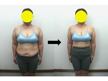 宮崎整体院/【ダイエットコース】