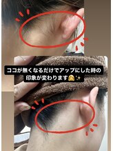 ケアアネラ(KeaAnela)/うなじ美人に！