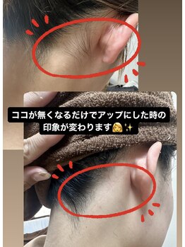 ケアアネラ(KeaAnela)/うなじ美人に！