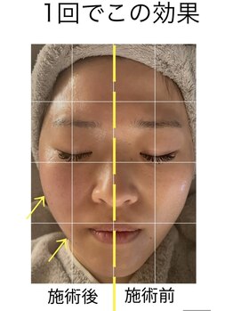 プラスベル(plus Belle)/