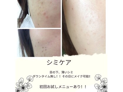 サロン ド ビューティー ラ デュースの写真