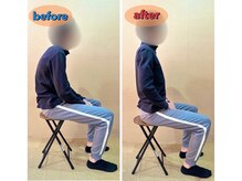 東京脊柱専門整体院/姿勢矯正ビフォーアフター