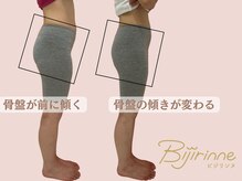 ビジリンヌ/骨盤　広島市