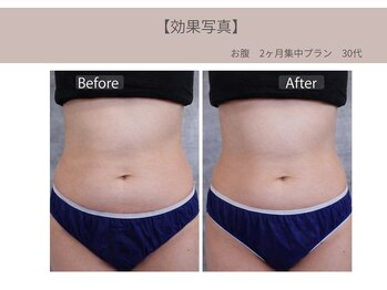 ミライ 福岡筑紫野店(mirai)/なりたいを叶えるボディメイク