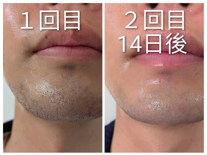 フォーティーワン(FORTY-ONE)の写真