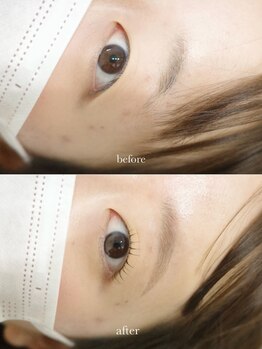 キルナノール 福岡天神(kiruna norr)/魅力を引き出すセットメニュー