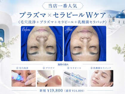 エイトスキン(8skin)の写真