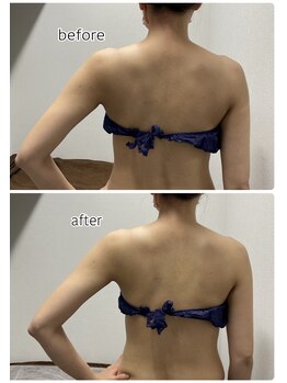 エンチャント(ENCHANT)/ブライダル前は超音波リフト