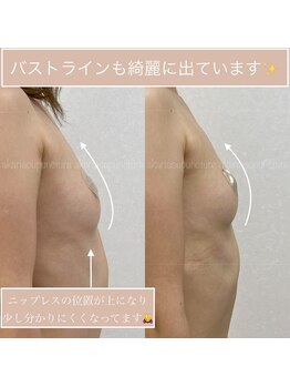 アカリ(AKARI)/美胸・バストアップ鍼灸