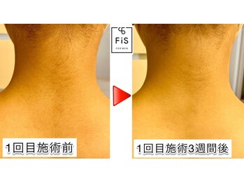 フィズ 大井町店(FIS)