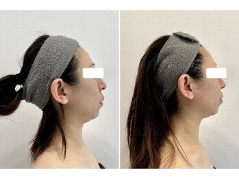 ファンシアジーク(Fanciasieg.)/韓国式美顔コルギ