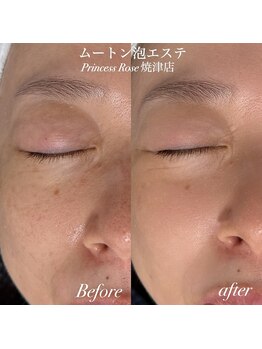 プリンセスローズ 焼津店(Princess Rose)/ムートン泡エステ