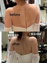 スピードスタイル(Speed Style)/ブライダルエステ