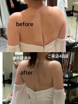 スピードスタイル(Speed Style)/ブライダルエステ