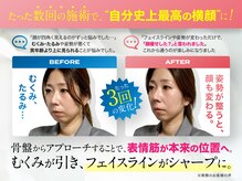 理想の小顔 横浜店