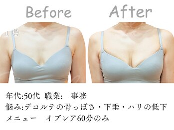 シエル(Siele)/「年齢とともにハリが低下」…