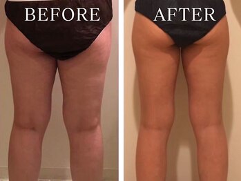 ヨサパーク ニコナ 三軒茶屋南口(YOSA PARK nicona)/ルルオンダイエットでの変化♪