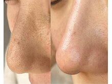 アイスリー(i III)