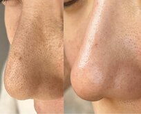 アイスリー(i III)