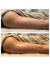 スターエステ(STAR ESTHE)/