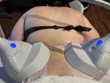 エミナル(Eminal)/◆脂肪冷却　腰