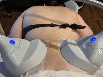 エミナル(Eminal)/◆脂肪冷却　腰