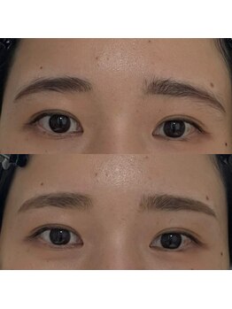 ネマウム(nemaum)/正面からみてもすごく変わる☆