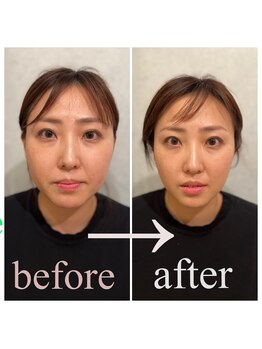 東京G整体/小顔矯正ビフォーアフター◎