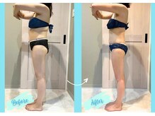 千歳の女神 西尾本店/【施術風景】Before/After