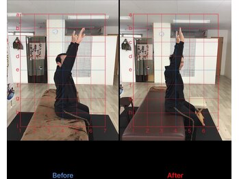 ストレチックス 近江八幡店/BeforeAfter