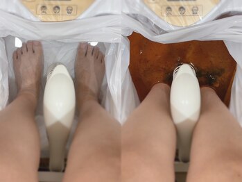 エルプラス(L+)/フットデトックス