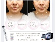 小顔ウナ学芸大学店(UNA)