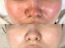 ウォナ(WONA)の雰囲気（一時的な効果ではなく本気の"肌質改善"へ向けて）