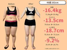 ニドム/48歳　-16kgの痩身ダイエット1