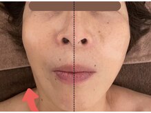 メルシー サロン(Merci Salon)/弾力肌引き上げハリ感アップ！