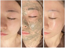 ビーユービー(BUB)の雰囲気（目指せ陶器肌！お肌のお悩み、何でもお気軽にご相談ください♪）