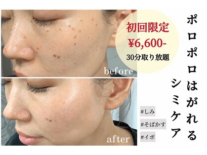 キビック(KIBIK)の写真