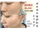 キビック(KIBIK)の写真