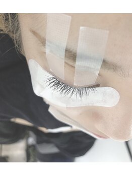 セサニー(SE SUNNY)/ビフォー