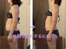 テールボーテ(Terre beaute)/二の腕ケア(シェイプ)