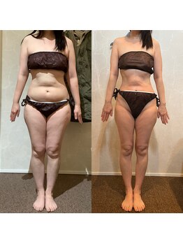 ラナ 甲府本店(Lana)/お客様のビフォーアフター