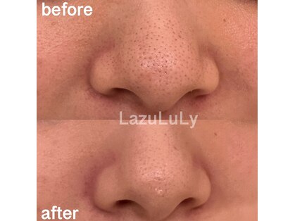ラズリ(LazuLuLy)の写真