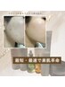 【お肌の無料カウンセリング】