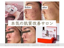 ホワイトアクア 南海難波店(WHITE AQUA)の雰囲気（エステ初心者の方も多数ご来店!私たちにお任せ下さい★！）