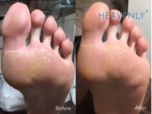 ヘブンリープラス＋ Luz湘南辻堂店/タコ 魚の目 フット ネイルケア