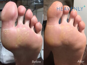 ヘブンリープラス＋ Luz湘南辻堂店/タコ 魚の目 フット ネイルケア