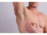 【メンズ脱毛】男性も蒸れる脇毛を無くしたい方急増中！ワキ脱毛初回お試し