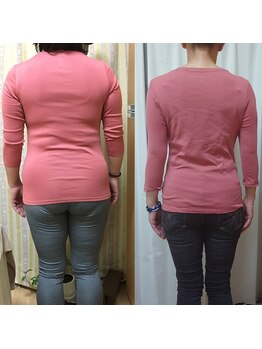 エテルノ(eterno)の写真/知識×技術×結果にこだわる体内改善ダイエット５キロ～１０キロ以上痩せるなら耳つぼで食事のコントロール